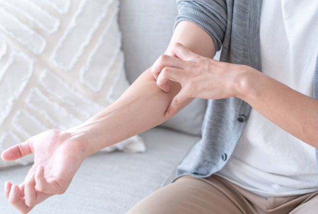 蕁麻疹（じんましん）とは